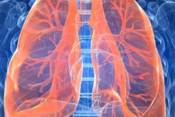 10 Guidelines To Keep Your Lungs Healthy